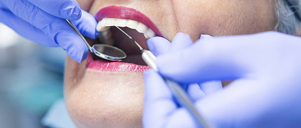 Best Same-Day Emergency Dental Services in Lamont, MI